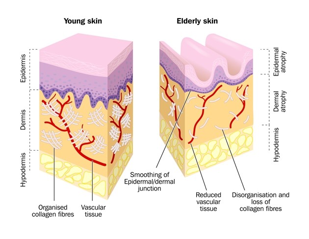 collagen-comparison-by-age